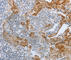 B-Raf Proto-Oncogene, Serine/Threonine Kinase antibody, A2988, ABclonal Technology, Immunohistochemistry paraffin image 