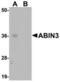 TNFAIP3 Interacting Protein 3 antibody, TA306824, Origene, Western Blot image 