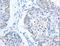 5'-Aminolevulinate Synthase 1 antibody, LS-C404478, Lifespan Biosciences, Immunohistochemistry paraffin image 