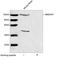 Glutamate Ionotropic Receptor NMDA Type Subunit 1 antibody, LS-C203243, Lifespan Biosciences, Western Blot image 