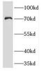 Potassium voltage-gated channel subfamily A member 2 antibody, FNab04662, FineTest, Western Blot image 