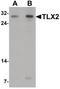 T Cell Leukemia Homeobox 2 antibody, PA5-34554, Invitrogen Antibodies, Western Blot image 