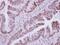Decapping Enzyme, Scavenger antibody, NBP2-16110, Novus Biologicals, Immunohistochemistry frozen image 