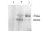 Proprotein Convertase Subtilisin/Kexin Type 9 antibody, TA303007, Origene, Western Blot image 