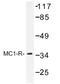 Melanocortin 1 Receptor antibody, AP01272PU-N, Origene, Western Blot image 