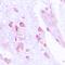 Abhydrolase Domain Containing 12B antibody, orb224144, Biorbyt, Immunohistochemistry paraffin image 