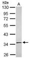 Solute Carrier Family 25 Member 36 antibody, NBP2-20391, Novus Biologicals, Western Blot image 