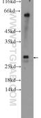 Ubiquitin Conjugating Enzyme E2 J2 antibody, 17713-1-AP, Proteintech Group, Western Blot image 