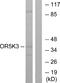 Olfactory Receptor Family 5 Subfamily K Member 3 antibody, A18799, Boster Biological Technology, Western Blot image 