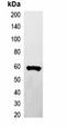 Glutathione-S-Transferase Tag antibody, orb323047, Biorbyt, Western Blot image 
