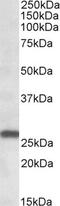 NPC Intracellular Cholesterol Transporter 2 antibody, 42-456, ProSci, Western Blot image 