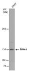 Phosphorylase Kinase Regulatory Subunit Alpha 1 antibody, PA5-78104, Invitrogen Antibodies, Western Blot image 