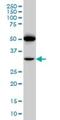 Prostacyclin receptor antibody, H00005739-M01, Novus Biologicals, Western Blot image 