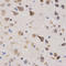 Karyopherin Subunit Alpha 4 antibody, LS-C331831, Lifespan Biosciences, Immunohistochemistry paraffin image 