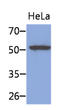 K8 antibody, AM50038PU-S, Origene, Western Blot image 