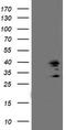 Signal Sequence Receptor Subunit 1 antibody, TA503265, Origene, Western Blot image 