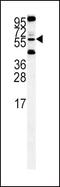 Htra antibody, PA5-11413, Invitrogen Antibodies, Western Blot image 