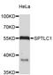 Serine palmitoyltransferase 1 antibody, STJ25684, St John
