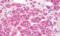 GAL1 antibody, MBS248023, MyBioSource, Immunohistochemistry paraffin image 