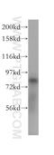 Family With Sequence Similarity 160 Member B2 antibody, 17147-1-AP, Proteintech Group, Western Blot image 