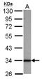 Sideroflexin 1 antibody, LS-C155711, Lifespan Biosciences, Western Blot image 