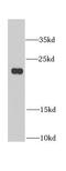 Biliverdin Reductase B antibody, FNab00911, FineTest, Western Blot image 
