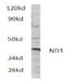 Malonyl-CoA-acyl carrier protein transacylase, mitochondrial antibody, AP01487PU-N, Origene, Western Blot image 