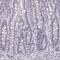Keratin 74 antibody, PA5-61778, Invitrogen Antibodies, Immunohistochemistry frozen image 
