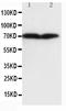 Collagen Type III Alpha 1 Chain antibody, MA1029, Boster Biological Technology, Western Blot image 