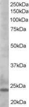 BCL2 Like 11 antibody, 45-330, ProSci, Western Blot image 