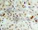 RB Transcriptional Corepressor 1 antibody, AP0175, ABclonal Technology, Immunohistochemistry paraffin image 