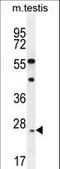 Rhophilin Associated Tail Protein 1 Like antibody, LS-B9616, Lifespan Biosciences, Western Blot image 