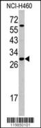 Serine And Arginine Rich Splicing Factor 5 antibody, 62-364, ProSci, Western Blot image 