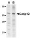 Caspase-12 antibody, TA306141, Origene, Western Blot image 