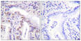 Sentrin-specific protease 6 antibody, abx013230, Abbexa, Western Blot image 