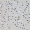 MYCN Proto-Oncogene, BHLH Transcription Factor antibody, LS-C335093, Lifespan Biosciences, Immunohistochemistry frozen image 