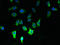 Mitochondrial Calcium Uniporter Dominant Negative Beta Subunit antibody, LS-C379655, Lifespan Biosciences, Immunofluorescence image 
