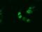 Aryl Hydrocarbon Receptor Nuclear Translocator Like antibody, GTX84853, GeneTex, Immunocytochemistry image 