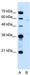 Coiled-Coil Domain Containing 112 antibody, TA335966, Origene, Western Blot image 