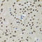 V(D)J recombination-activating protein 2 antibody, LS-C334173, Lifespan Biosciences, Immunohistochemistry paraffin image 
