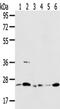 Proteasome Subunit Beta 8 antibody, TA351358, Origene, Western Blot image 