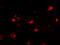 Mex-3 RNA Binding Family Member A antibody, A15239, Boster Biological Technology, Immunofluorescence image 