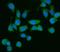 Malic Enzyme 1 antibody, A03449-3, Boster Biological Technology, Immunofluorescence image 