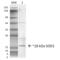 Superoxide Dismutase 1 antibody, SPC-206D-ALP, StressMarq, Western Blot image 