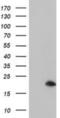ADP Ribosylation Factor Like GTPase 5B antibody, NBP2-01669, Novus Biologicals, Western Blot image 
