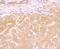 Galectin 8 antibody, NBP2-75501, Novus Biologicals, Immunohistochemistry paraffin image 