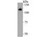 ATPase Sarcoplasmic/Endoplasmic Reticulum Ca2+ Transporting 1 antibody, NBP2-76891, Novus Biologicals, Western Blot image 