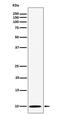 NOP10 Ribonucleoprotein antibody, M07394, Boster Biological Technology, Western Blot image 
