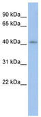 Jumonji Domain Containing 6, Arginine Demethylase And Lysine Hydroxylase antibody, TA343773, Origene, Western Blot image 