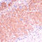 Cytochrome P450 11B2, mitochondrial antibody, 15-536, ProSci, Immunohistochemistry frozen image 